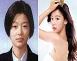 Jun Ji-hyun before surgery
